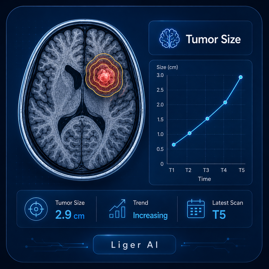 DeepBT AI brain tumor analysis dashboard showing axial MRI contours and tumor-volume trend over time